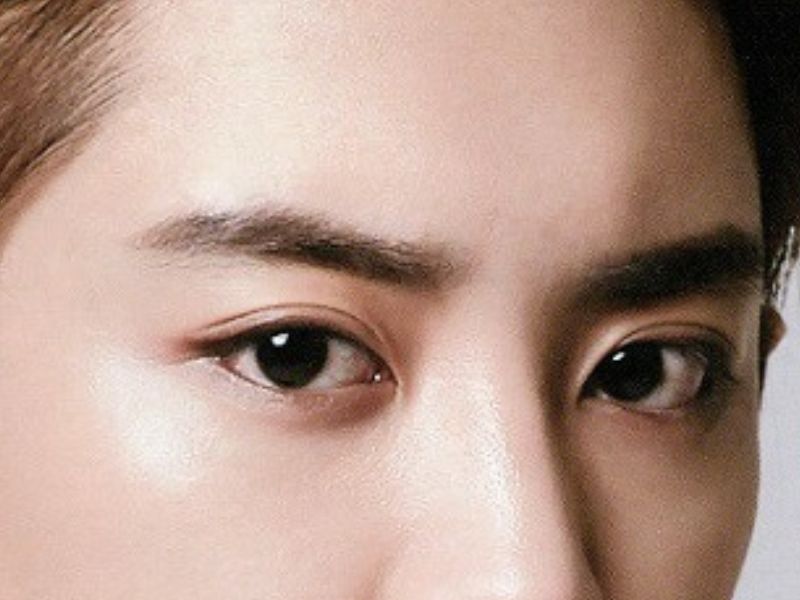 bấm mí mắt cho nam