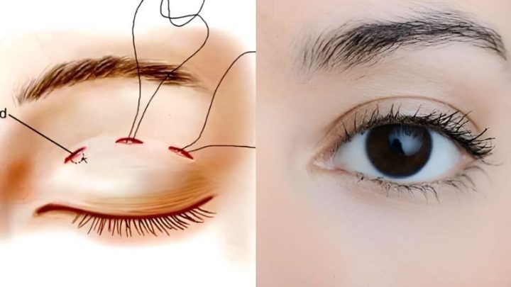 bấm mí mắt giữ được bao lâu