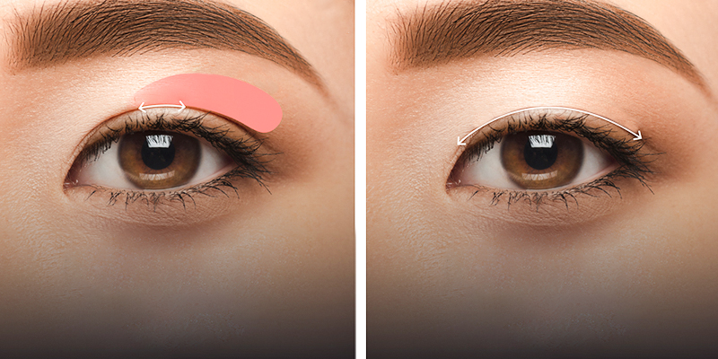 bấm mí đẹp hay cắt mí đẹp hơn