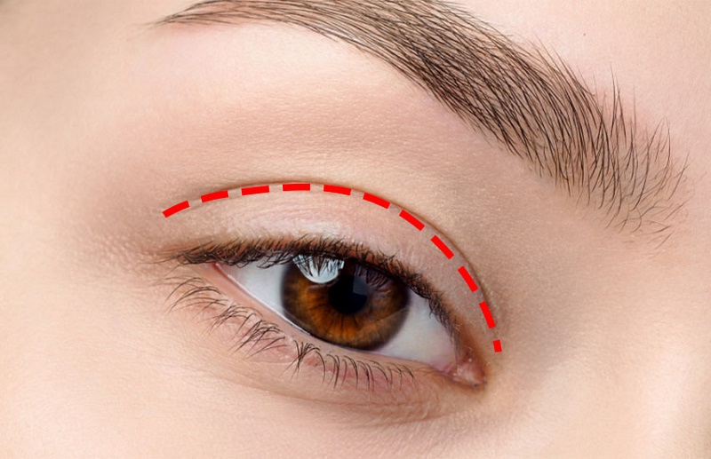 bấm mắt 2 mí có cần kiêng ăn không