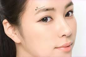 treo chân mày có hết sụp đuôi mắt không