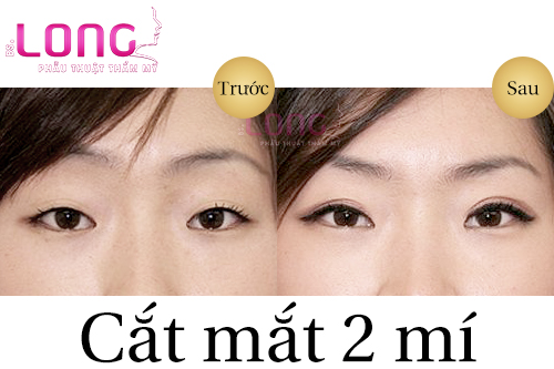 cat-mat-2-mi-cho-nguoi-mat-xech-co-doi-tuong-duoc-khong-1