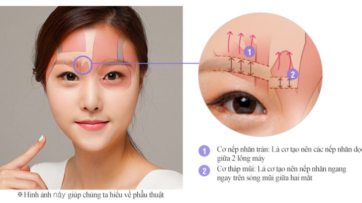 treo-chan-may-noi-soi2