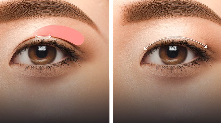 bấm mí đẹp hay cắt mí đẹp hơn