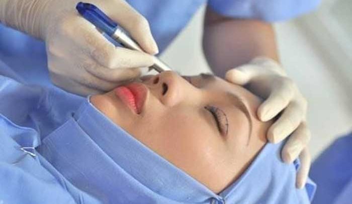 bác sĩ bấm mí mắt đẹp tphcm