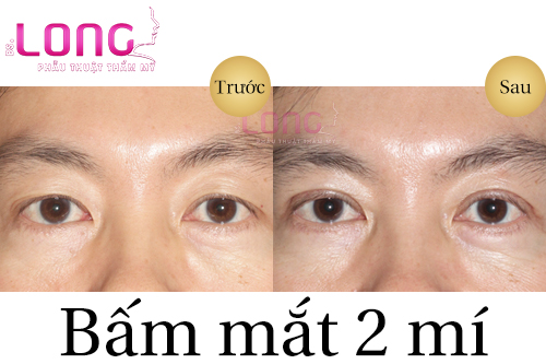 ky-thuat-bam-mat-2-mi-cho-nam-nhu-the-nao-1